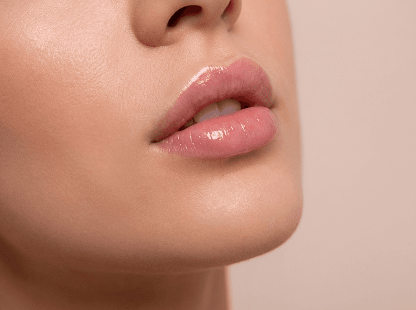 Dermal fillers